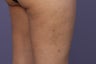 Cellulaze