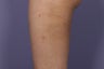 Cellulaze