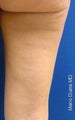 Cellulaze