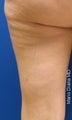 Cellulaze