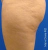 Cellulaze