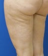 Cellulaze