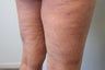Cellulaze