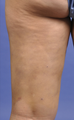 Cellulaze