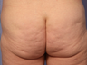 Cellulaze