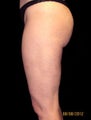 Cellulaze