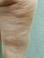 Cellulaze