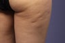 Cellulaze