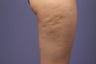 Cellulaze