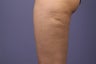 Cellulaze