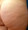 Cellulaze