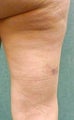 Cellulaze
