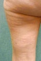 Cellulaze