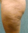 Cellulaze