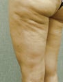Cellulaze