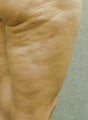 Cellulaze