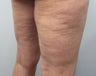 Cellulaze