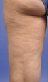 Cellulaze