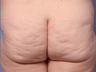 Cellulaze