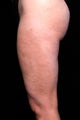 Cellulaze