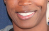 Dimple Creation