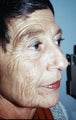 Challenging anti-aging combo case