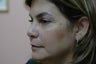 Hetter facial resurfacing