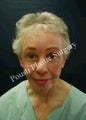 Chin Implants, Dermabrasion, Face Lift, Forehead Lift, Neck Lift
