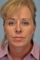 A fresh look for this patient