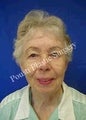 Chin Implants, Dermabrasion, Face Lift, Forehead Lift, Neck Lift