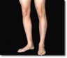 Calf Implant