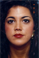 septoplasty, cleft lip repair