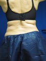 Coosculpting