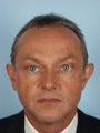 Otoplasty in Adult Male