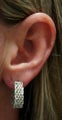 Earlobe Repair