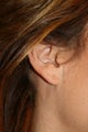 Ear Lobe Repair