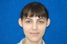 Otoplasty