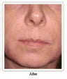 Evolence: a naturally younger-looking you