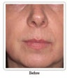 Evolence: a naturally younger-looking you