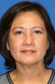 Upper Blepharoplasty,Lower Blepharoplasty, and Lower Eyelid Skin Pinch