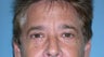 Eyelid Surgery For Men