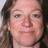 Upper Blepharoplasty