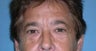 Eyelid Surgery For Men