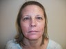 Upper & Lower Eyelid Lift and Brow Lift combination