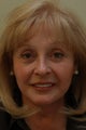 Facial Rejuvenation
