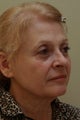 Face & Neck Lift