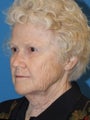 Lower Facelift and Necklift with Platysmaplasty