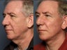 Facelift