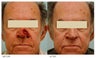 Facial Reconstruction