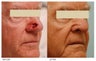Facial Reconstruction